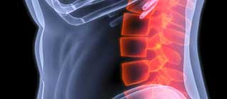 back-pain-statistics